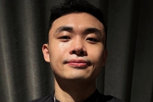中年男人的痛🥹 原帅社媒：上个月植了个头发 效果不错！